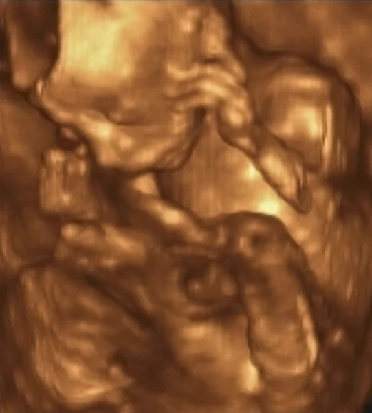 Ultrasound Echography of a 4th Month fetus, Italy