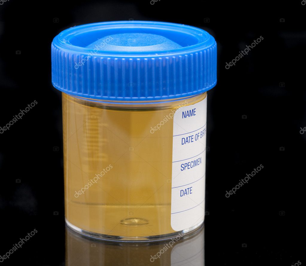 urine sample