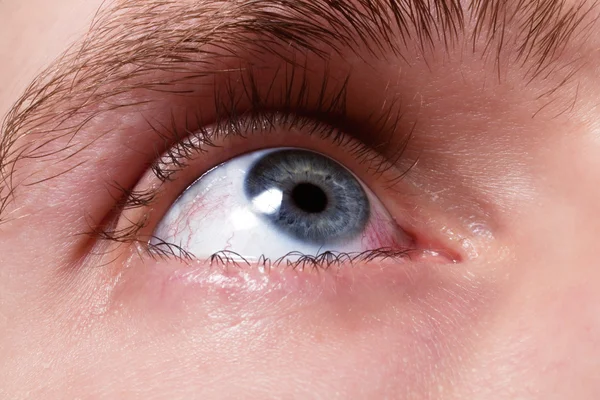 Blue men eye with red blood vessels