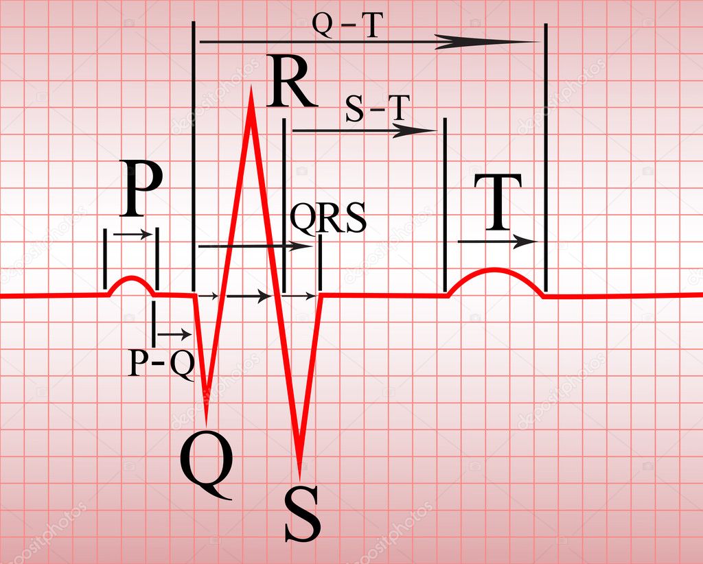 intervalo pr electrocardiograma