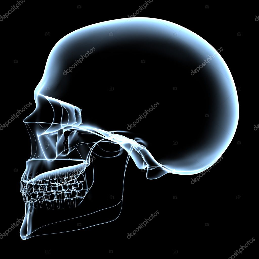 cranial x ray