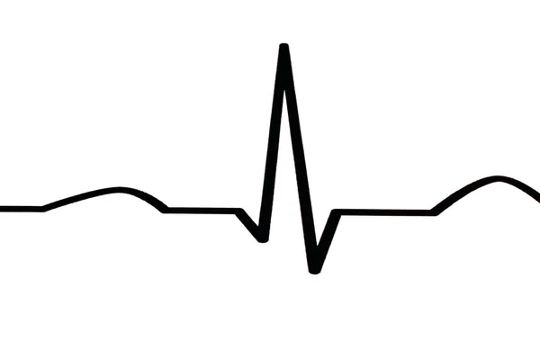 ECG diagram