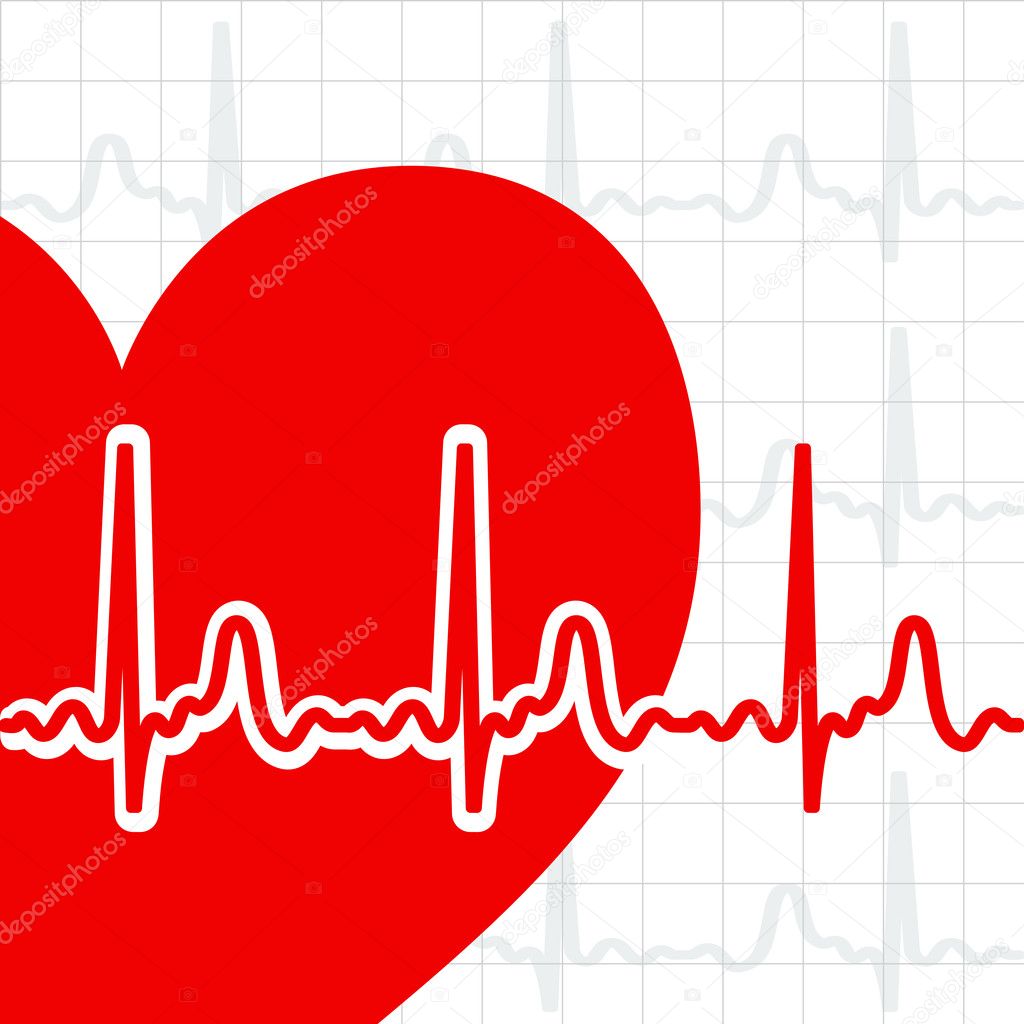 heart cardiogram