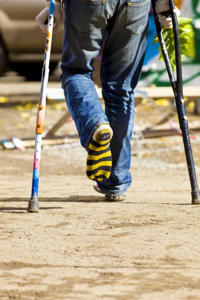 Color crutch and broken leg in striped sock — Stock Photo #4975646