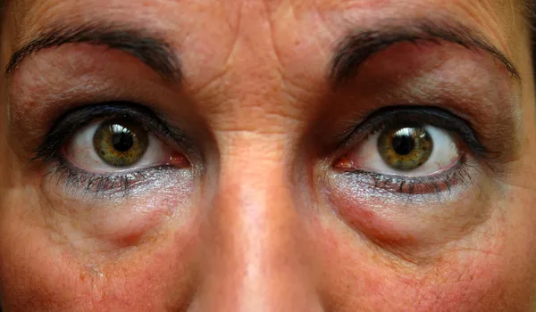 Close up of tired woman eyes