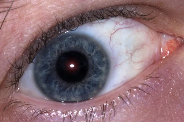 Human Eye Pupil
