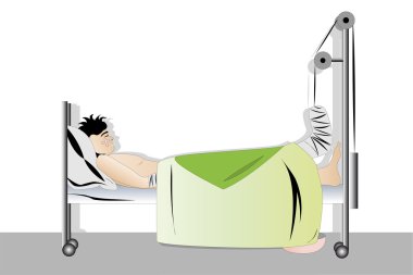 Vector illustration of sleeping man with fracture leg clipart