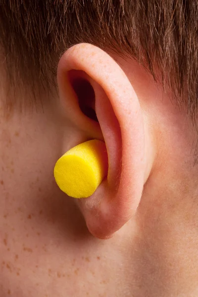 Gelber Ohrstöpsel Das Ohr Aus Nächster Nähe — Stockfoto