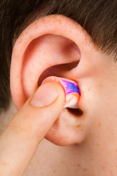 Farbige Ohrstöpsel Das Ohr Aus Nächster Nähe — Stockfoto