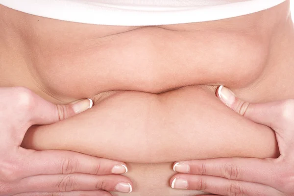 Gordura parte do corpo feminino . — Fotografia de Stock