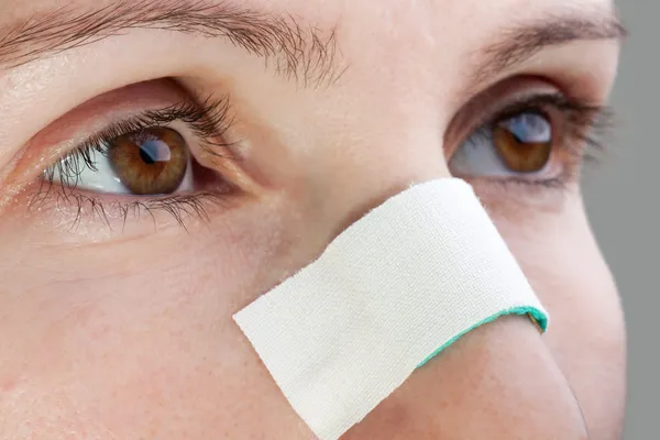 Plaster on wound nose — Stock Photo, Image