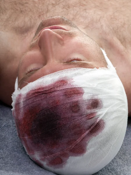 Bandage på såret huvud — Stockfoto