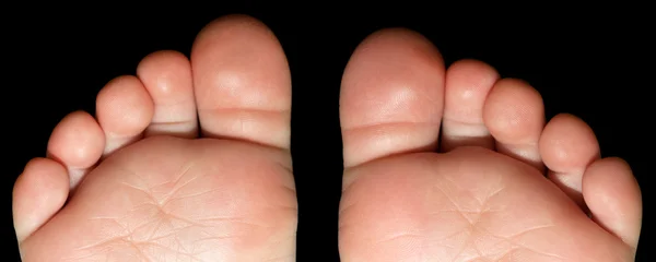 Dětské nohy jediný prst — Stock fotografie