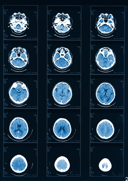 Рентгеновская компьютерная томография — стоковое фото
