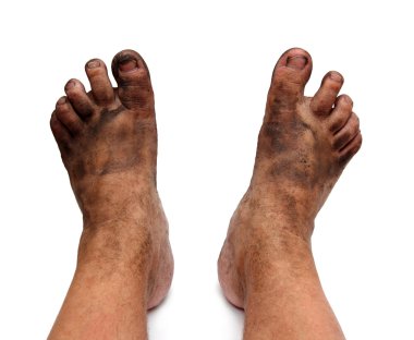 Dirty unhygienic foots clipart