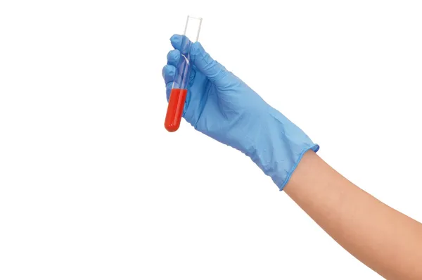 Blood for antidote — Stock Photo, Image