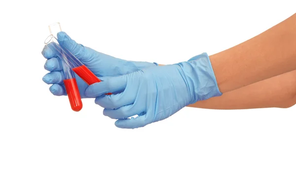 Samples of bloods — Stock Photo, Image