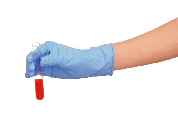 Sample of bloods — Stock Photo, Image