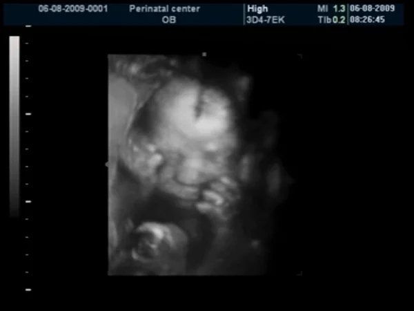 胎児超音波 — ストック写真