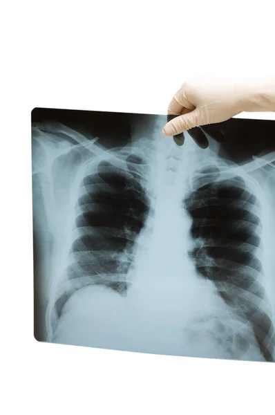 Hand holding x-ray image of human body — Stock Photo, Image