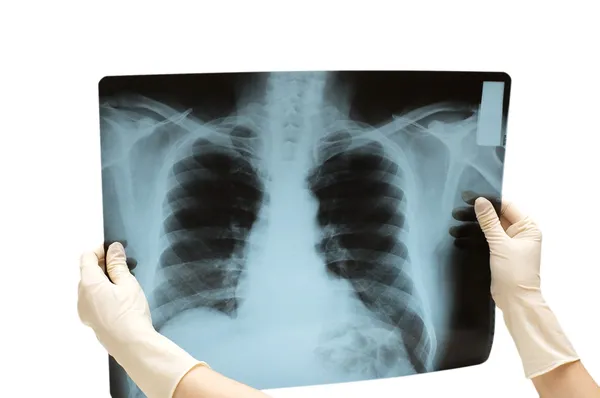Dos manos sosteniendo la imagen de rayos X del cuerpo humano — Foto de Stock