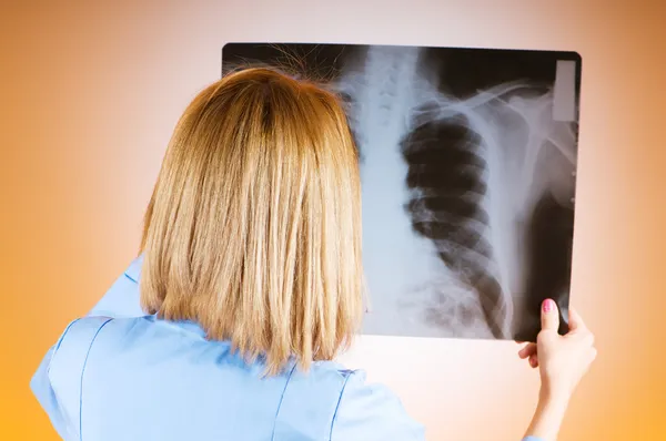 Женщина врач тщательно рентген пациента — стоковое фото