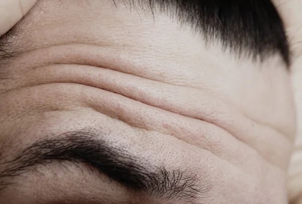 Arrugas - frente que muestra tensión y miedo —  Fotos de Stock