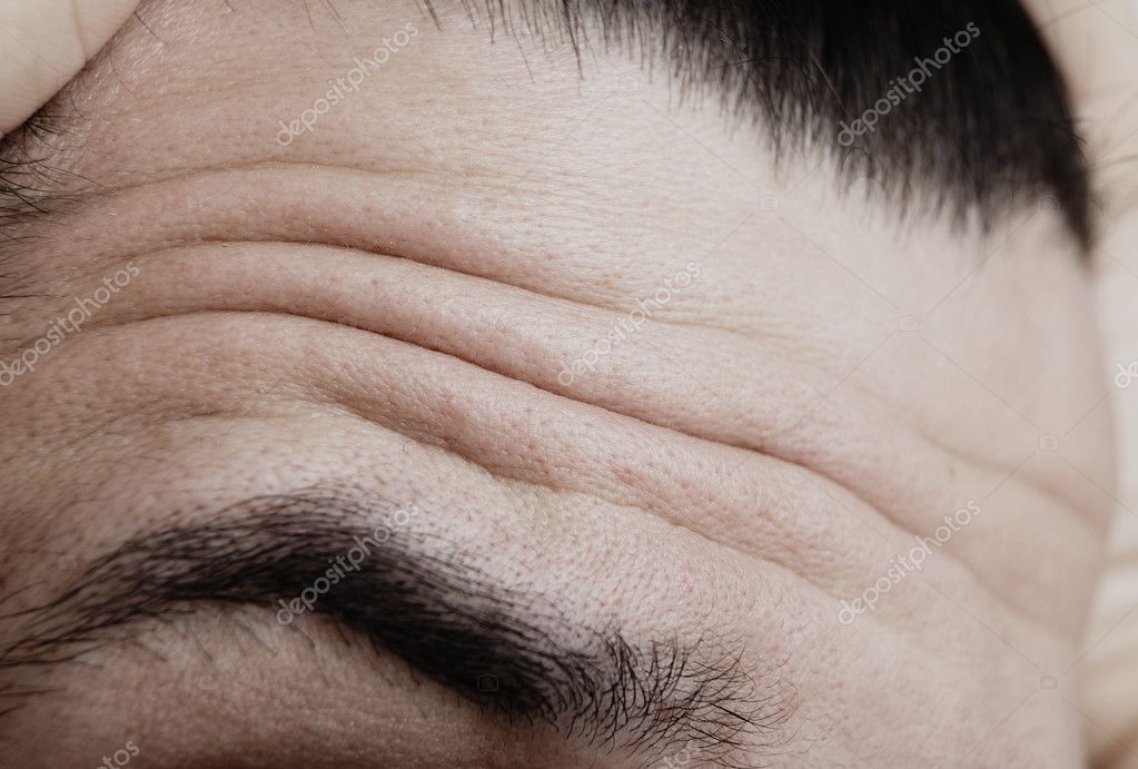 Der auf sichtbar adern dayheartlesri: stirn Was bedeutet