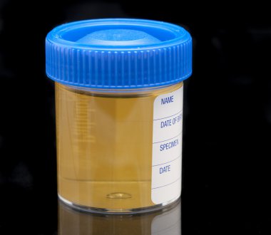 Urine test specimen clipart