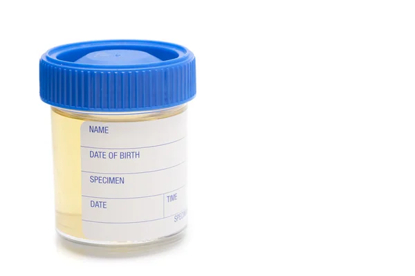 Urine sample — Stock Photo, Image