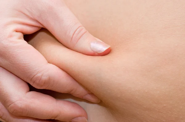 Ragazza con una cellulite su uno stomaco — Foto Stock