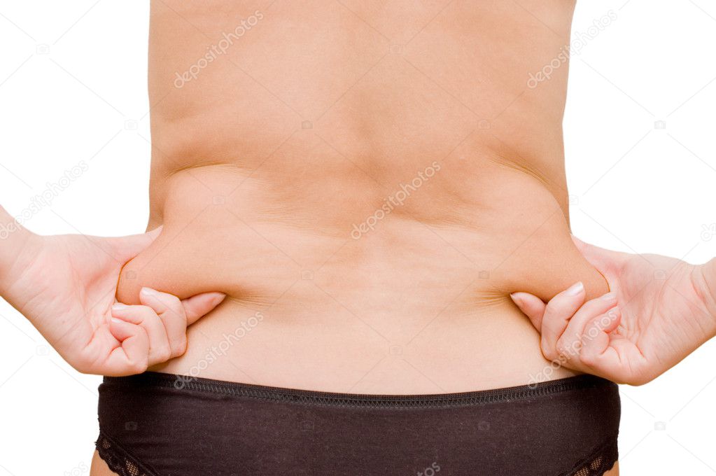 Girl with a cellulitis on a stomach