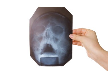 X-ray picture of a head in a hand clipart