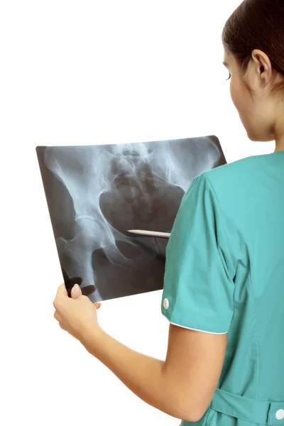 Médecin Féminin Examinant Une Image Radiographique Accent Est Mis Sur — Photo
