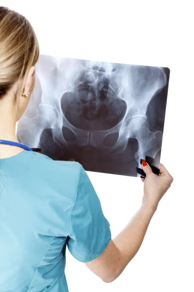 Medico donna che esamina un'immagine a raggi X . — Foto Stock
