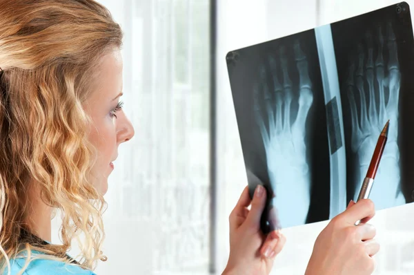 Arzt Analysiert Röntgenaufnahmen Krankenhaus — Stockfoto