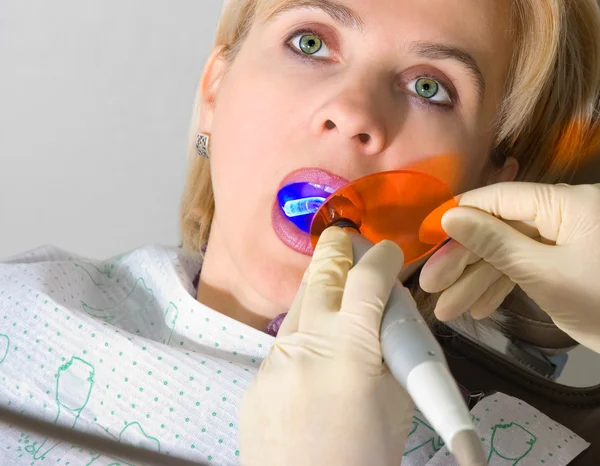 Dentista Ilumina Paciente Lámpara Ultravioleta Sobre Relleno Del Diente —  Fotos de Stock