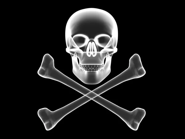 Skull and crossbones x-ray silhouette — Stock Photo © madbit #4286835