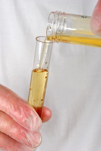 Alguma urina humana num frasco de amostra — Fotografia de Stock