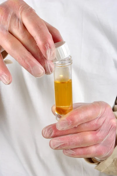 Some human urine in a sample bottle — Stock Photo, Image