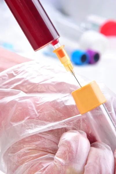 Etwas menschliches Blut für einen Test vorbereiten — Stockfoto