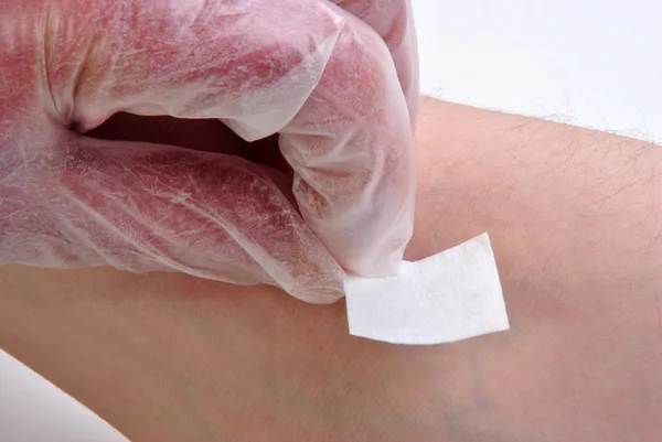 Чистая кожа со стерильным мазком перед инъекцией — стоковое фото