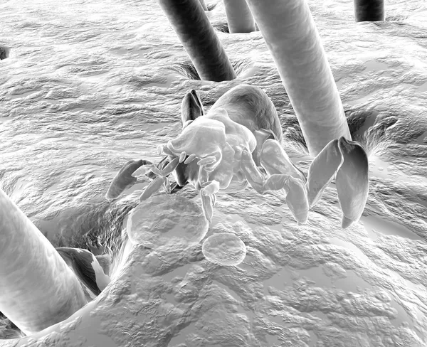 Acarien Cootie Une Tique Avec Microscope Électronique — Photo