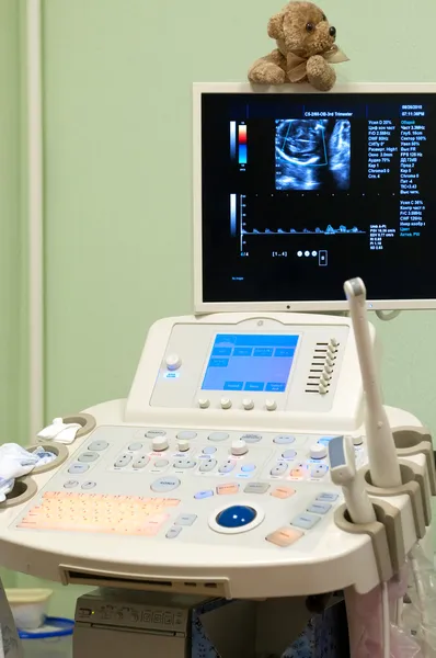 Medicinsk utrustning ultraljud genomsökning. diagnos av graviditet. — Stockfoto