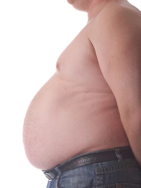 Nagy hasa egy kövér ember — Stock Fotó