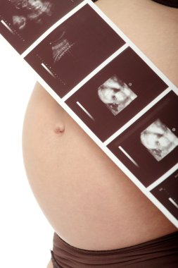 A pregnant woman is holding her stomach and a photo of her Ultrasound. clipart