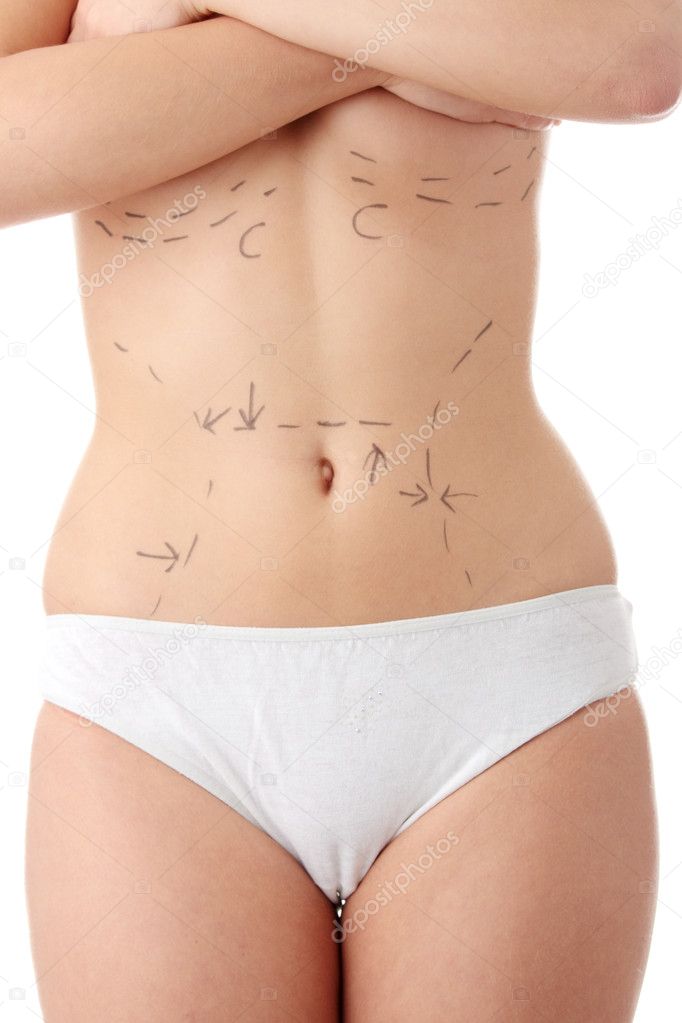 Caucasian woman's abdomen marked with lines