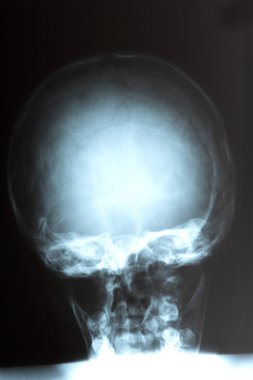 Head on black and white x-ray film clipart