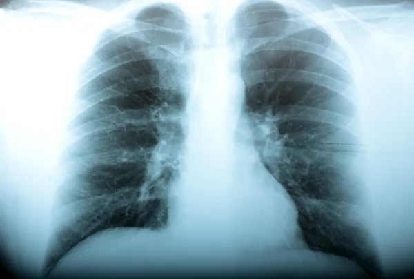 방사선과 — 스톡 사진