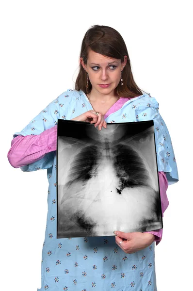 Een Mooie Vrouwelijke Patiënt Houden Een Röntgenfoto Van Borst — Stockfoto
